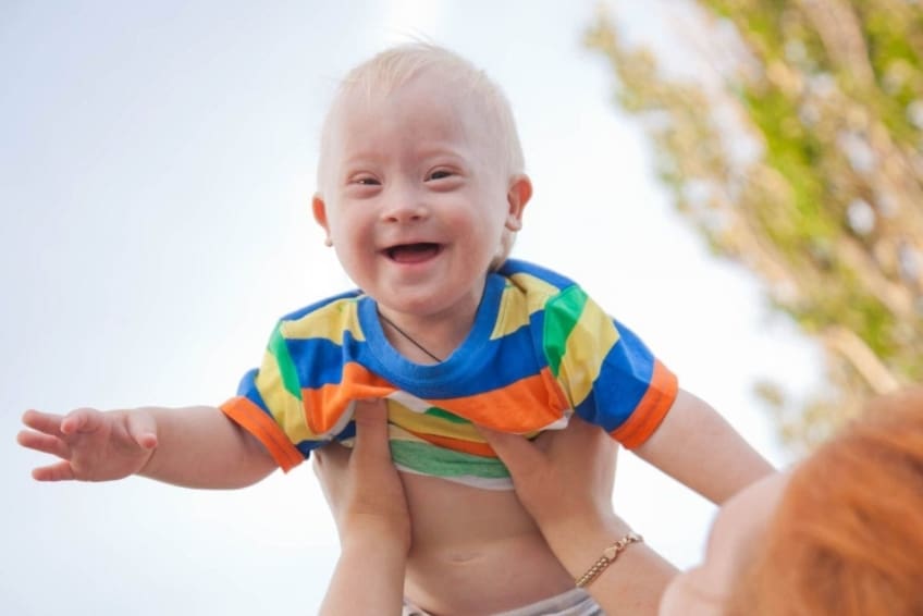 Caring for a Baby Who Has Down Syndrome - staging.familydoctor.org