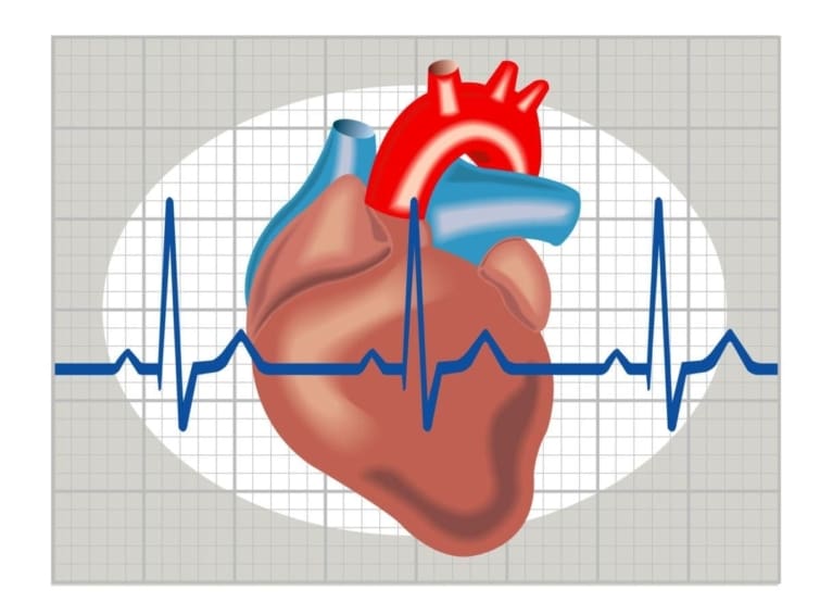 Cardioverter-Defibrillator: A Treatment for Arrhythmia - staging ...