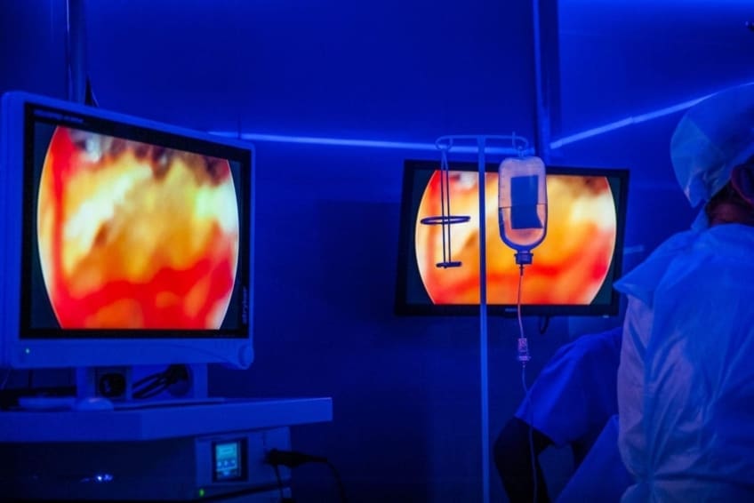monitors in an operating room assist during laparoscopic surgery