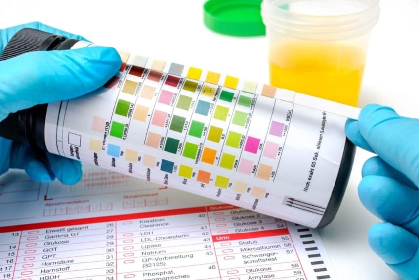 gloved hands holding a ketone test strip for a urine analysis
