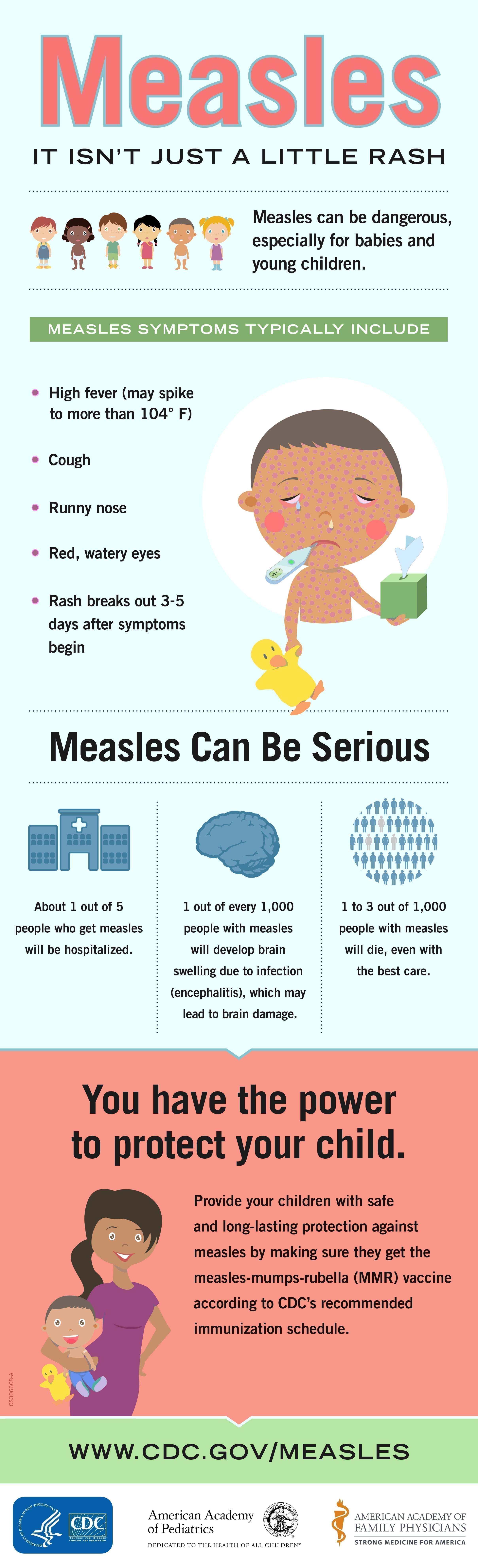 Measles can be serious
